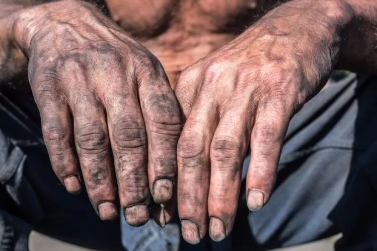 Nezaposleni ne žele raditi za opće dobro kako bi dobili socijalnu pomoć