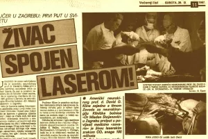 Presječeni živac prvi put je spojen pomoću lasera u Zagrebu 25. rujna 1987. (presnimka iz Večernjeg lista) 